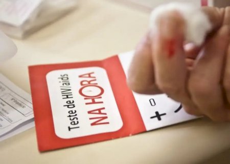 Aids: Brasil tem alta de casos, mas menor mortalidade desde 2013