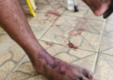 Idosa estava lavando louça quando foi esfaqueada em casa no Coophatrabalho
