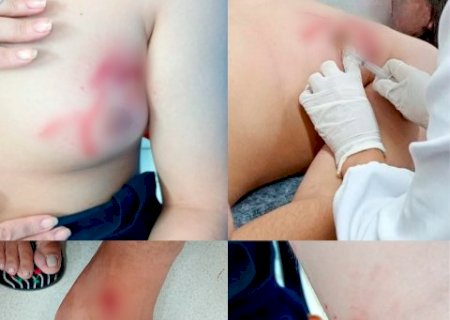 Adolescente de 14 anos é atacado por pitbull solto no Jardim Jacy