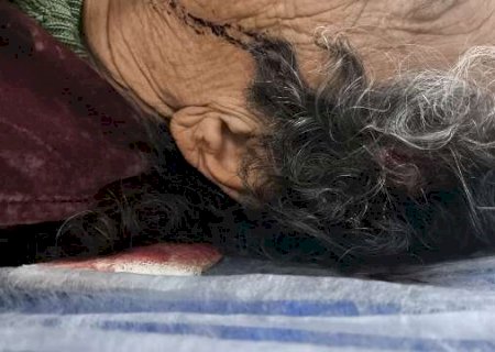 Pitbull invade casa, ataca idosa de 75 anos e tutor PM vai parar na delegacia