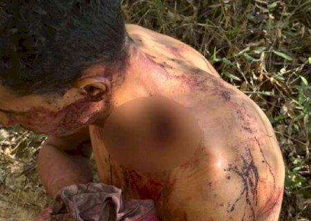 Nu e gravemente ferido, homem &eacute; resgatado pela Pol&iacute;cia Militar