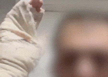 Em v&iacute;deo no hospital, marido queimado diz que esposa n&atilde;o quis mat&aacute;-lo