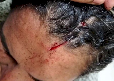 Separado h&aacute; um m&ecirc;s, homem ataca ex com fac&atilde;o no Centro de Campo Grande