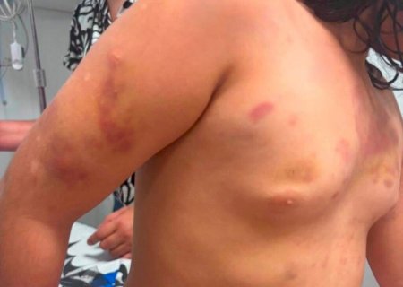 Em &aacute;udio, m&atilde;e de autista agredida diz que padrasto era "figura de pai"