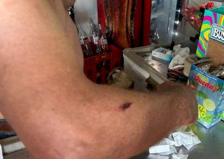 "N&atilde;o era minha hora", diz comerciante baleado de rasp&atilde;o em atentado com 16 tiros