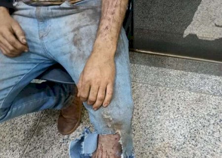 Jovem relata ataque de on&ccedil;a enquanto trabalhava em colheitadeira em &aacute;rea rural